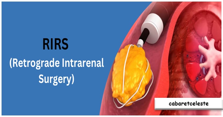 Proses Retrograde Intrarenal Surgery