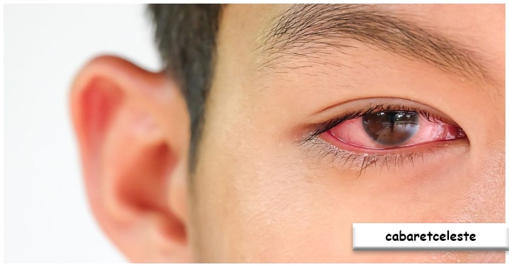 Pencegahan dan Perawatan Mata yang Sehat